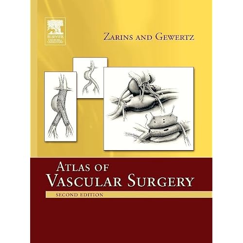 Atlas of Vascular Surgery - Paperback Edition 2nd Edition