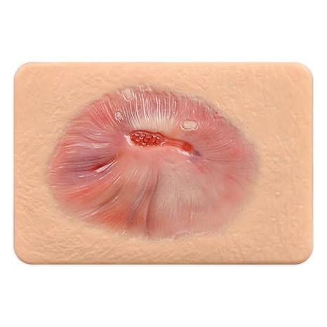 Healing Granulation Wound Simulation Models for Medical Education | Wound Care Demonstrations Tool