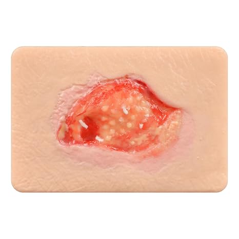 Unhealthy Granulation Wound Simulation Models for Medical Education | Wound Care Demonstrations Tool