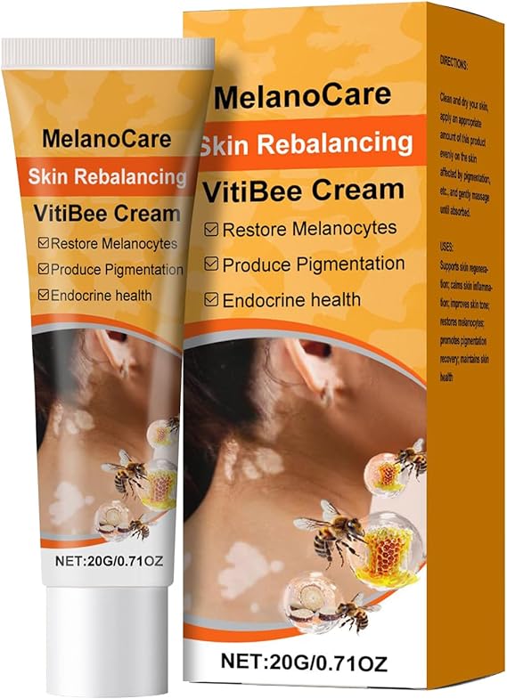 White Spot Removal Cream, Brightening Skin Lotion, Hydrating Face Cream, Targeted Spot Correction, With Hydrating And Brightening Formula, 1.81x3.66 Inches, For Daily Use On The Face And Body