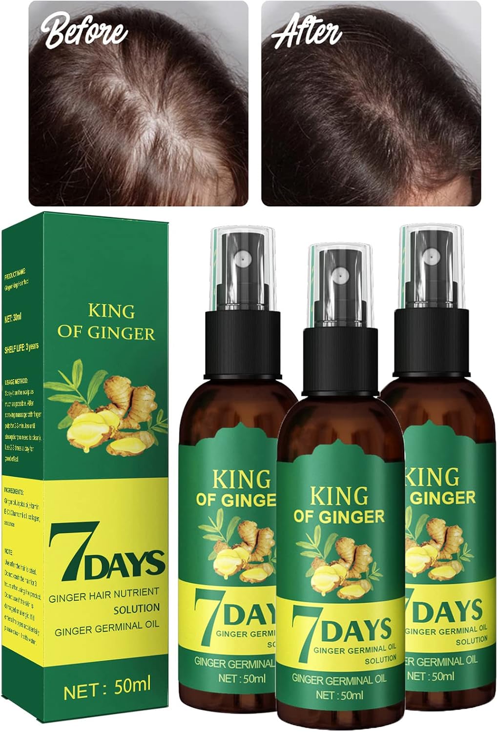 XIRUJNFD Shouga Kingu Hair Growth Oil, King of Ginger 7 Days Hair Growth, Shougagro Japanese Hair Growth Spray, Ginger Oil for Hair Growth, Anti-Hair Loss Oil 3Pcs