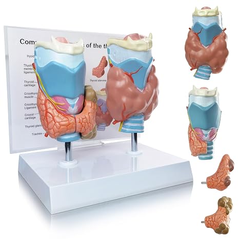 EVOTECH SCIENTIFIC Human Thyroid Pathology Anatomical Model - 4 Parts Life Size Medical Study Education Tool W/Stand and Manual for Demonstrating Goiter, Thyroid Cancer, and Graves Disease